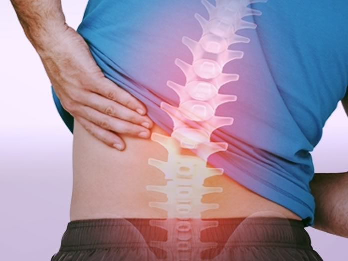 Mal di schiena lombare: cos'è, sintomi, rimedi, esercizi